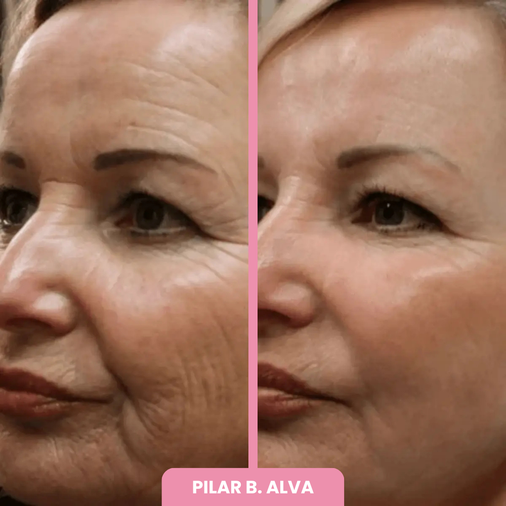 OFERTA 2x1 + BROCHA REGALO | Máscara de Colágeno Coreana 🇰🇷