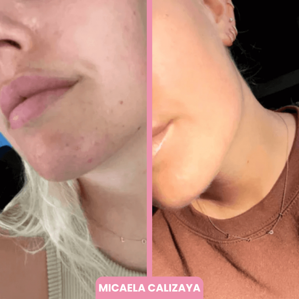 OFERTA 2x1 + BROCHA REGALO | Máscara de Colágeno Coreana 🇰🇷